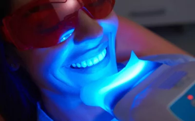 Tout savoir sur le blanchiment dentaire professionnel : Avantages et Essentiels