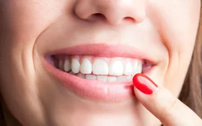Avant et Après un Blanchiment Dentaire: Ce Qu’il Faut Savoir